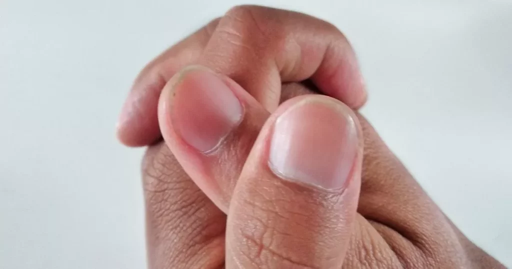 0 Hand Finger Nails Isolated On White Backgroundcloseup Thumb Healthy.jpg