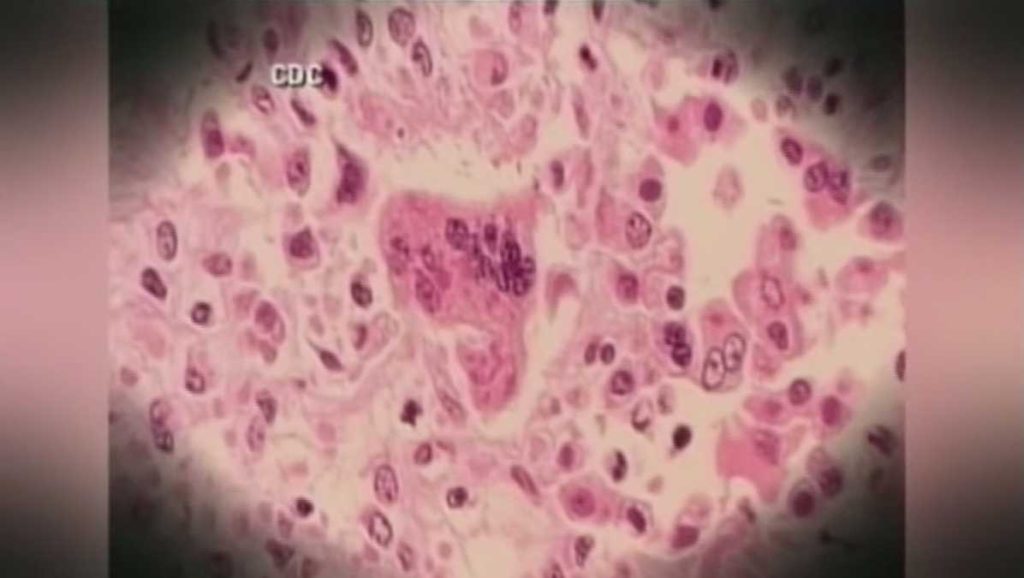 32653998 32653998.jpg