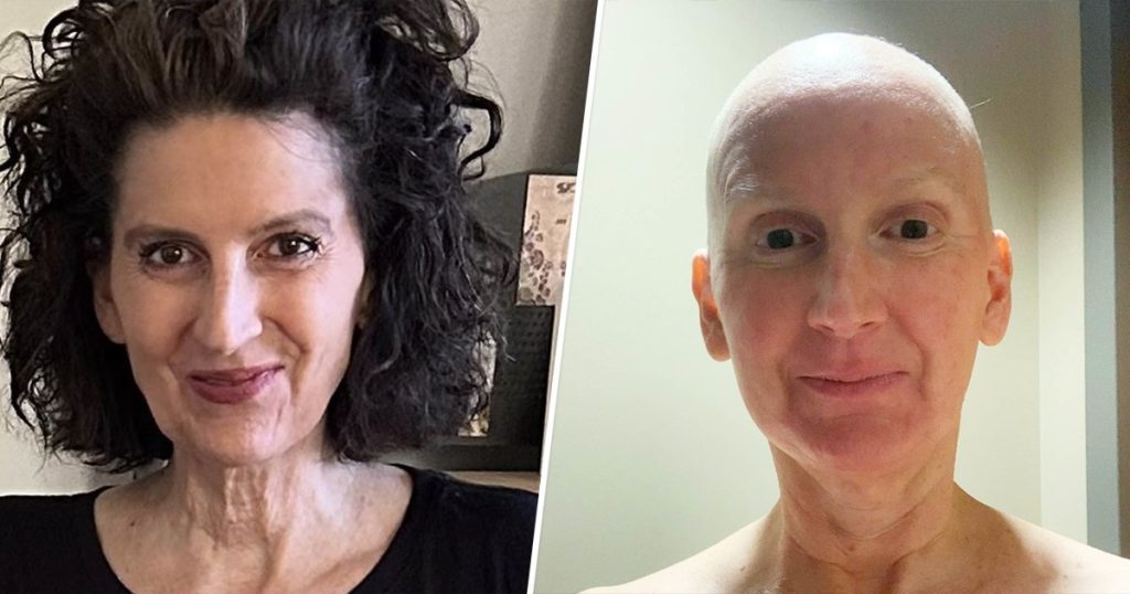 Beth Kitchin Leukemia Leg Pain Mc 2x1 240712 Copy 6751cb.jpg