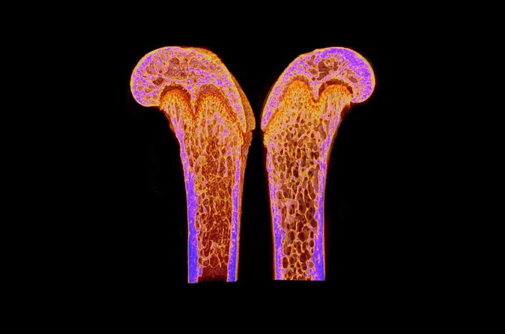 Bone Density Card.jpg