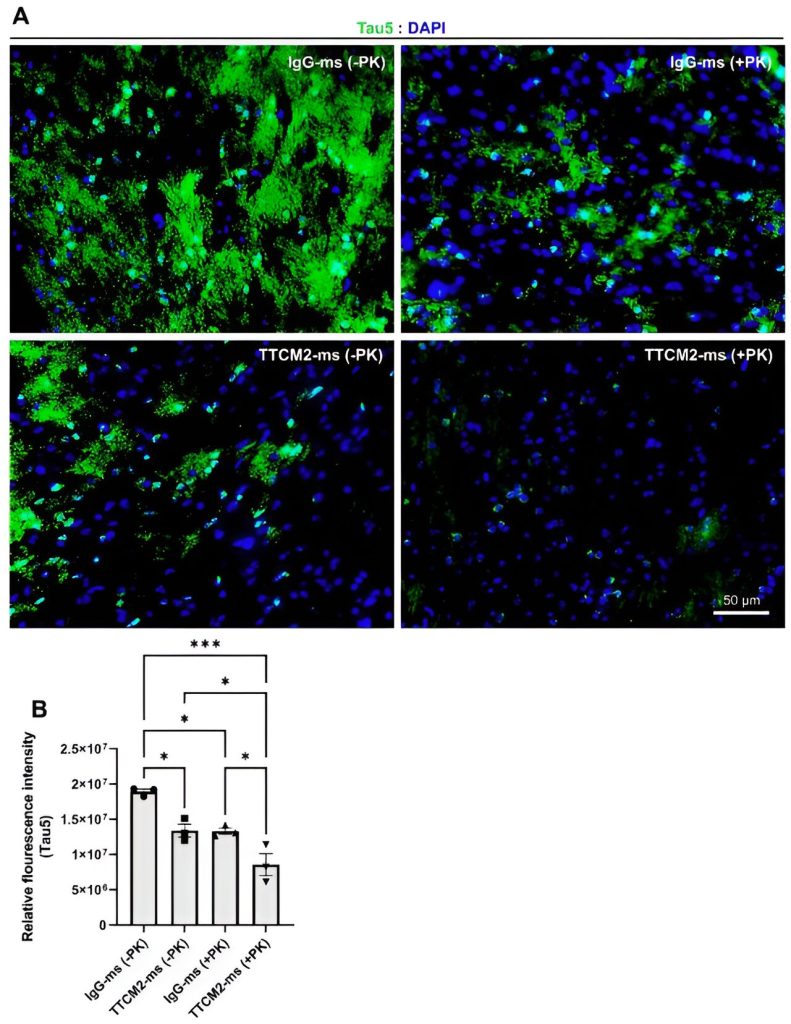 Nasal spray found to clear tau proteins from Alzheimer’s mouse model brains Nasal Spray Found To C.jpg