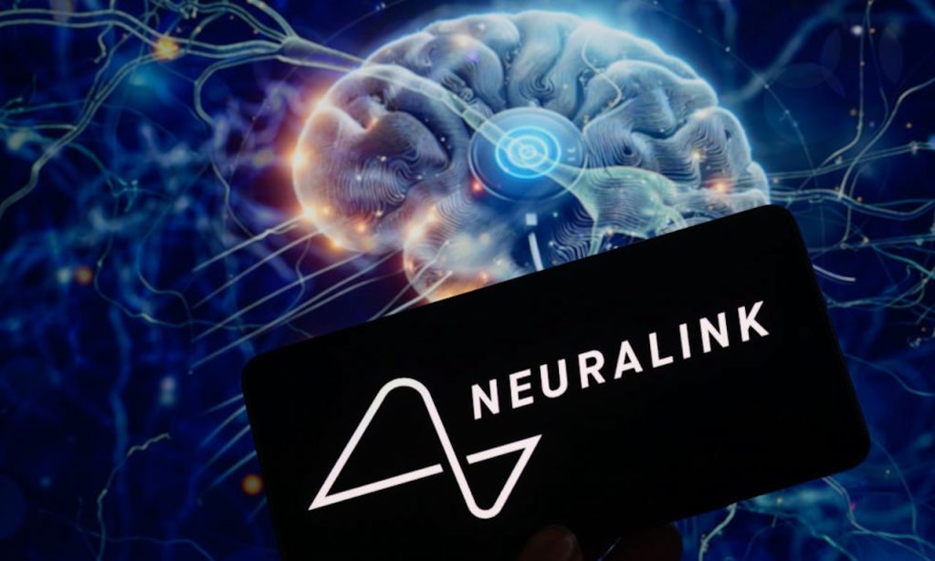 Neuralink Brain Implant.jpg