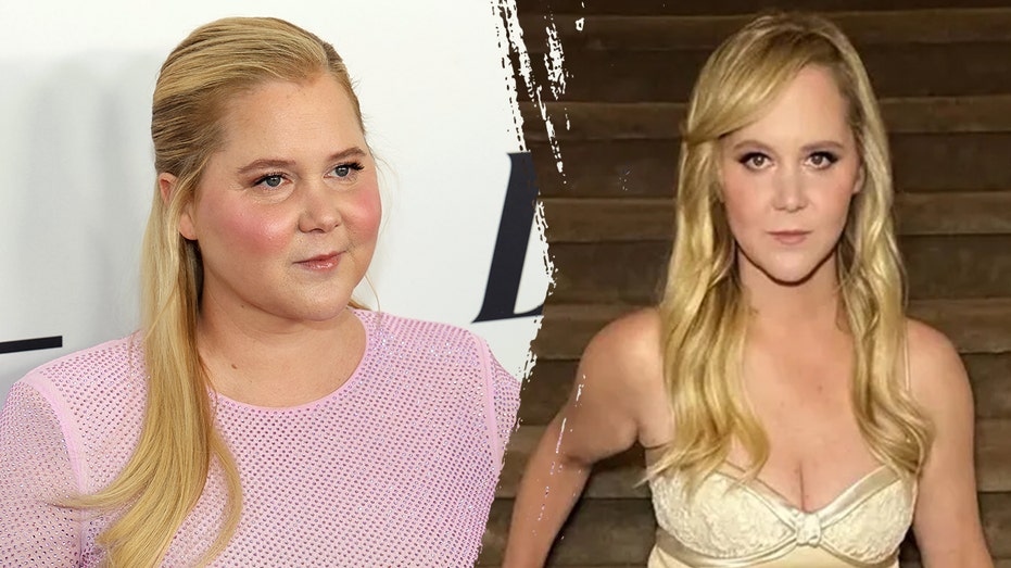 What to know about Cushing’s syndrome, which led to Amy Schumer's dramatic weight loss Amy schumer before after weight loss.jpg