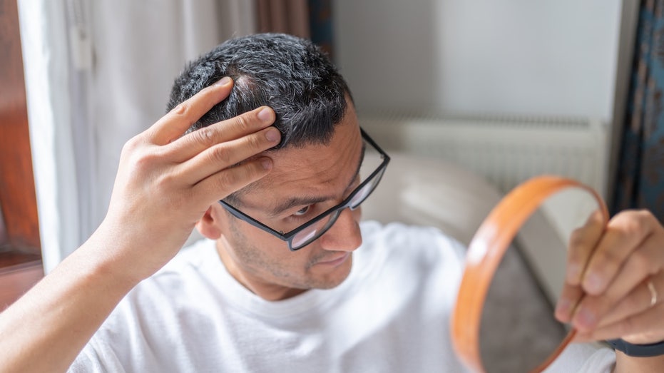 New baldness treatment shows dramatic hair-regrowth gains in major trial Man looking at hair in mirror.jpg