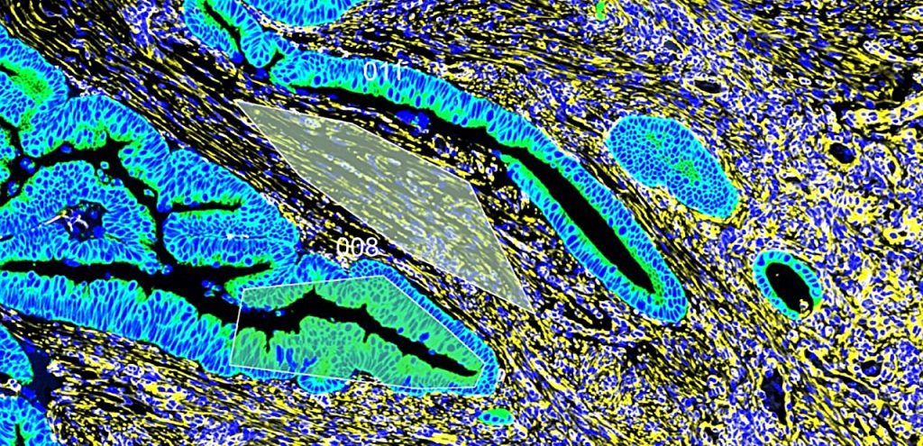 Stiffer colon could si.jpg